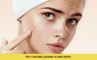 Top 7 Factors Leading to Skin Spots