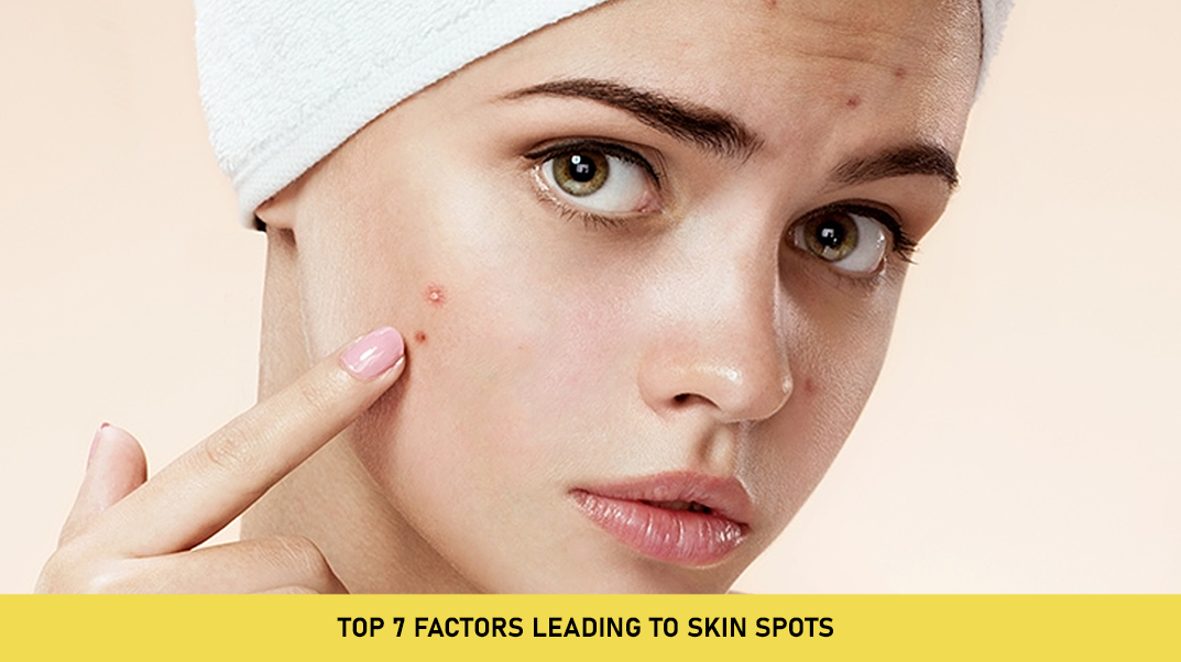 Top 7 Factors Leading to Skin Spots